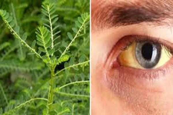 Not only medicines but also these home remedies will cure jaundice, use these things