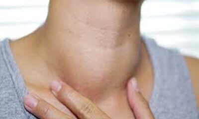 Know why women have thyroid, how to save?