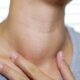 Know why women have thyroid, how to save?