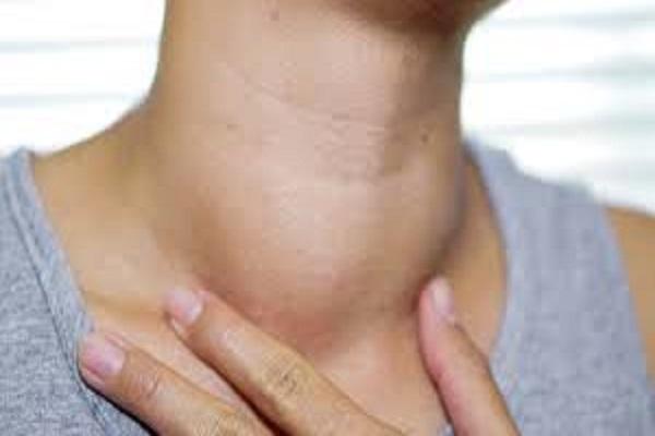 Know why women have thyroid, how to save?