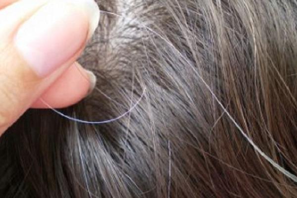 If you are also troubled by white hair, then follow these tips