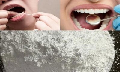 Remove all kinds of dental problems in a pinch, the right way to use it...