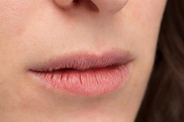 If chapped lips are a problem in winter then follow these home remedies