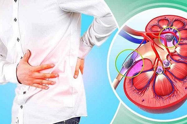 These symptoms of the body indicate that kidney stones have occurred, do not ignore them