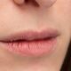 If chapped lips are a problem in winter then follow these home remedies