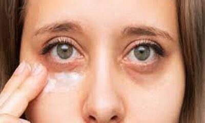 These home remedies will remove the dryness around the eyes, relief from fine lines too