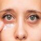 These home remedies will remove the dryness around the eyes, relief from fine lines too