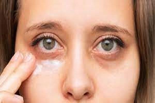 These home remedies will remove the dryness around the eyes, relief from fine lines too