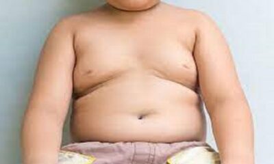If obesity is increasing in the child, parents should follow these methods to control it