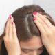 There will be no dandruff in the hair, only these home remedies will give relief from the problem