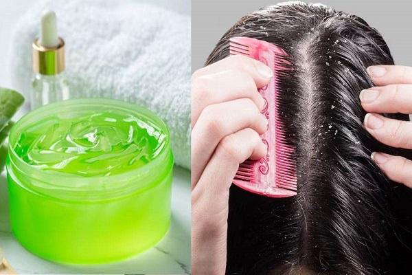 If you want to get rid of dandruff then use aloe vera in these ways