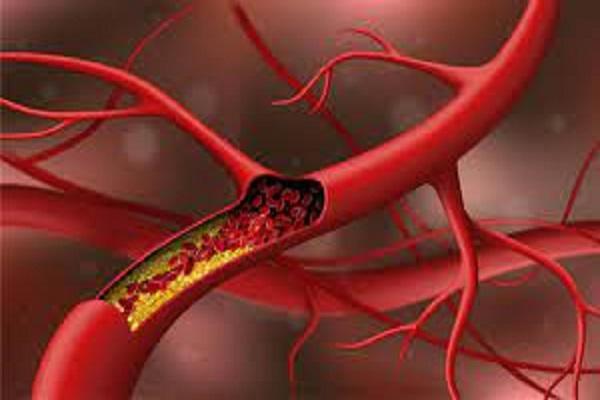 Cholesterol accumulated in nerves will melt, add these foods to your routine