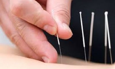 Free Acupuncture Medical Camp at Dr. Kotnis Acupuncture Hospital on 30