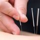 Free Acupuncture Medical Camp at Dr. Kotnis Acupuncture Hospital on 30