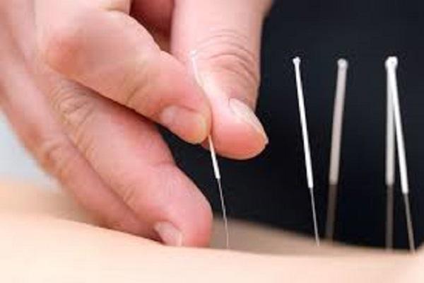 Free Acupuncture Medical Camp at Dr. Kotnis Acupuncture Hospital on 30